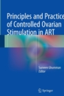 Principles and Practice of Controlled Ovarian Stimulation in ART - Book