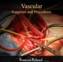 Vascular Surgeries and Procedures - eBook