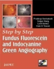 Step by Step (R) Fundus Fluorescein and Indocyanine Green Angiography - Book