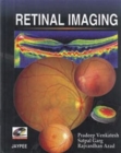 Retinal Imaging - Book