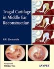 Tragal Cartilage in Middle Ear Reconstruction - Book