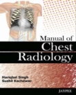 Manual of Chest Radiology - Book