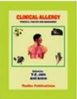 Clinical allergy - eBook