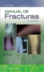 Manual de fracturas - Book