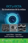 OCT y OCTA en trastornos de la retina - Book