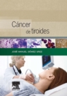 Cancer de tiroides : Presente y futuro - eBook
