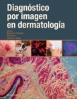 Diagnostico por imagen en dermatologia - eBook