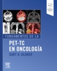 Fundamentos de la PET-TC en oncologia - eBook