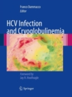 HCV Infection and Cryoglobulinemia - eBook