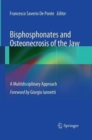 Bisphosphonates and Osteonecrosis of the Jaw: A Multidisciplinary Approach - Book