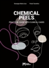 Chemical Peels : Practical Guide With Clinical Cases - Book