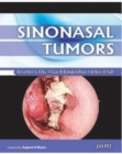 Sinonasal Tumors - Book
