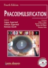 Phacoemulsification, Fourth Edition - Book