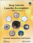 Deep Anterior Lamellar Keratoplasty Different Strokes - Book