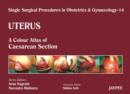 Single Surgical Procedures in Obstetrics and Gynaecology - Volume 14 - Uterus : A Colour Atlas of Caesarean Section - Book