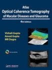 Atlas Optical Coherence Tomography of Macular Diseases and Glaucoma - Book