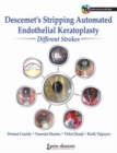 Descemet's Stripping Automated Endothelial Keratoplasty: Different Strokes - Book