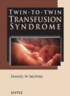 Twin-to-Twin Transfusion Syndrome - Book