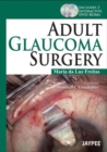 Adult Glaucoma Surgery - Book
