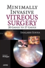 Minimally Invasive Vitreous Surgery: 20 Gauge to 27 Gauge - Book