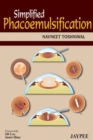 Simplified Phacoemulsification - Book