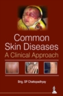 Common Skin Diseases : A Clinical Approach - Book