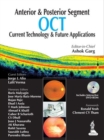 Anterior & Posterior Segment OCT: Current Technology & Future Applications - Book