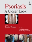 Psoriasis : A Closer Look - Book
