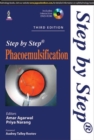 Step by Step Phacoemulsification - Book