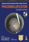 Jaypee Gold Standard Mini Atlas Series: Phacoemulsification - Book