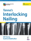 Tanna's Interlocking Nailing - Book