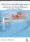 Actocardiogram : Analysis of Fetal Motion and Heart Rate - Book