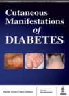 Cutaneous Manifestations of Diabetes - Book