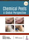Chemical Peels: A Global Perspective - Book