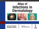 Atlas of Infections in Dermatology - Book