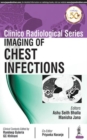 Clinico Radiological Series: Imaging of Chest Infections - Book