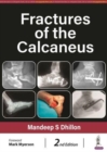 Fractures of the Calcaneus - Book