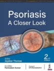 Psoriasis : A Closer Look - Book