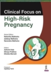 Clinical Focus on High-Risk Pregnancy - Book