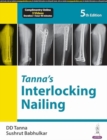 Tanna’s Interlocking Nailing - Book