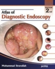 Atlas of Diagnostic Endoscopy - Book
