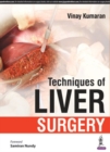 Techniques of Liver Surgery - Book