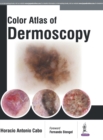 Color Atlas of Dermoscopy - Book
