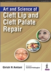 Art and Science of Cleft Lip and Cleft Palate Repair - Book