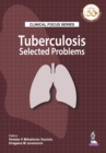 Clinical Focus Series: Tuberculosis : Selected Problems - Book