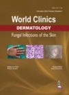 World Clinics Dermatology: Fungal Infections of the Skin : Volume 3, Number 1 - Book