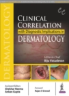 Clinical Correlation with Diagnostic Implications in Dermatology - Book