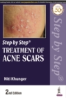 Step by Step Treatment of Acne Scars - Book