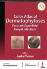 Color Atlas of Dermatophytoses : Focus on Superficial Fungal Infections - Book