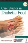 Case Studies in Diabetic Foot - Book